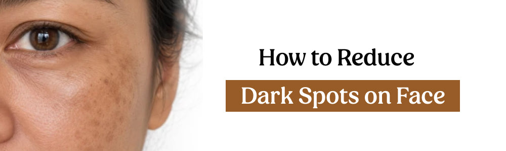 how to reduce dark spots on face