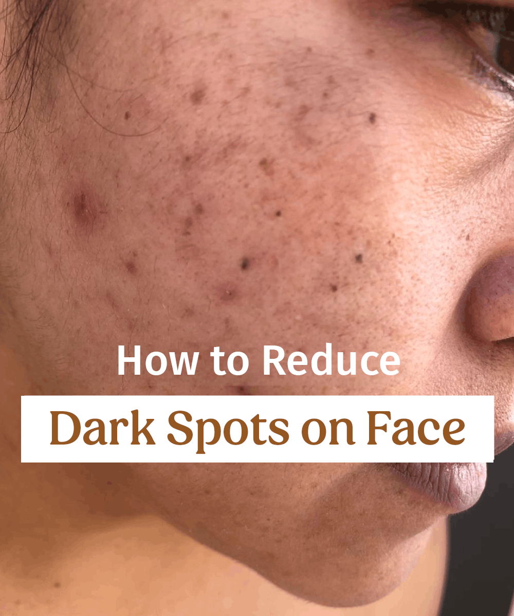 how to reduce dark spots on face