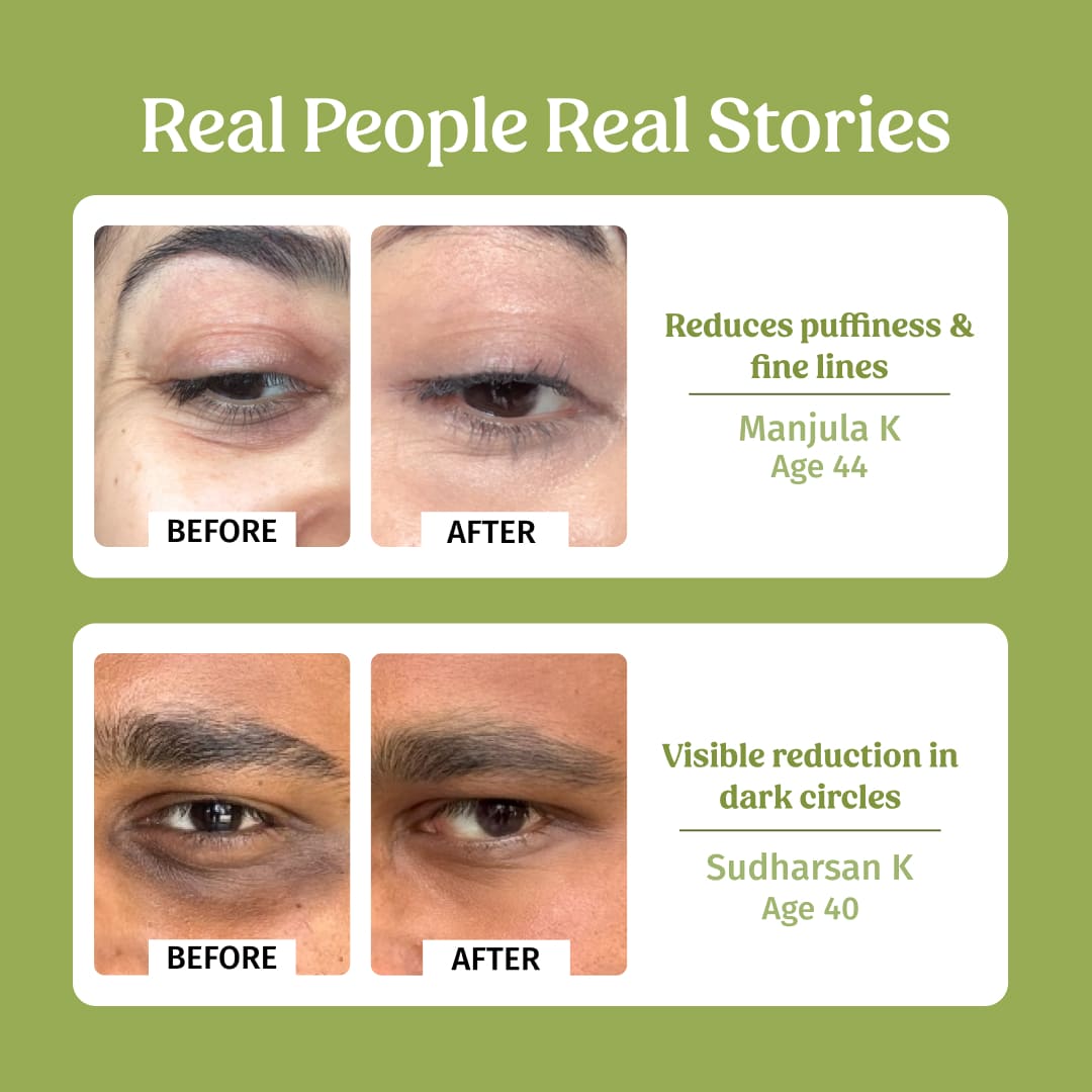 Under eye cream (Dark Circle Control)
