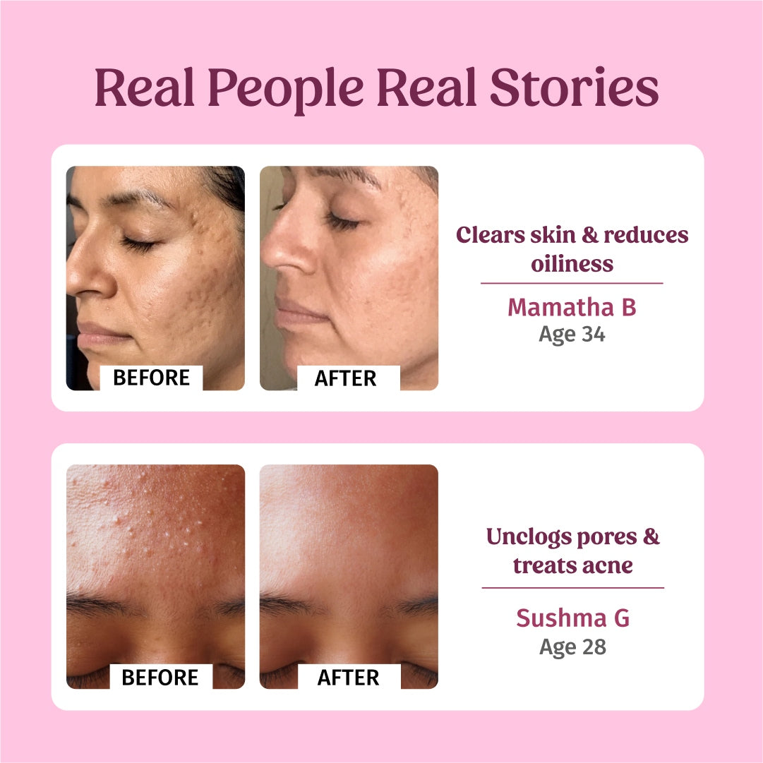 Rosewater Facial Toner (Hydration)