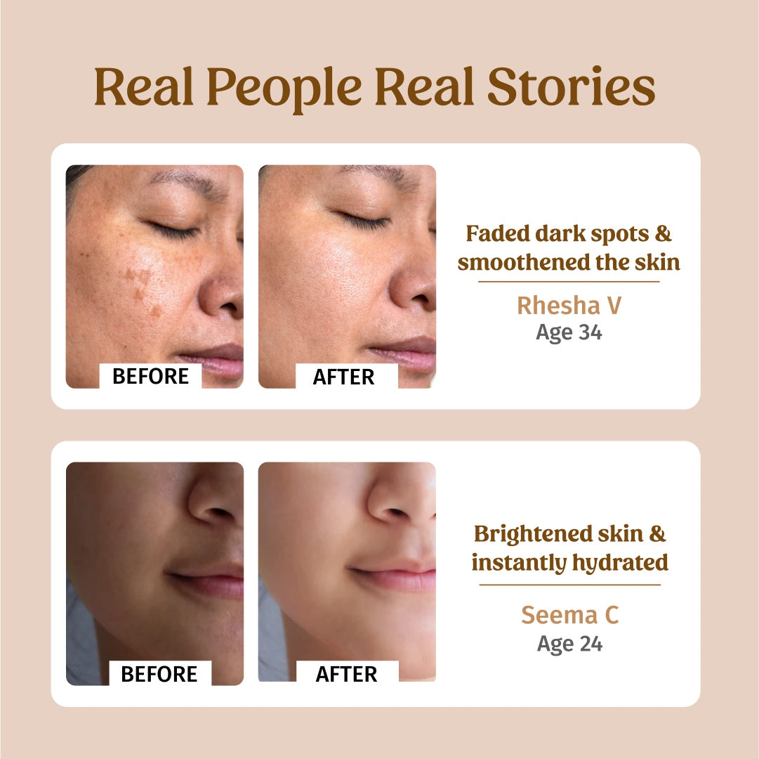 Ultra Moisturising Cream (Fine lines & Wrinkles)