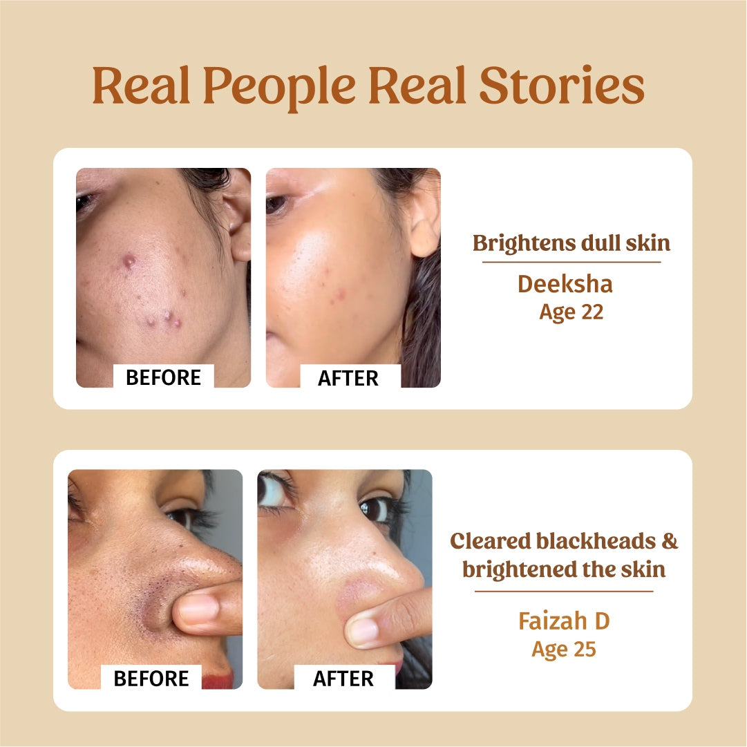 Face Brightening Kit (Large)