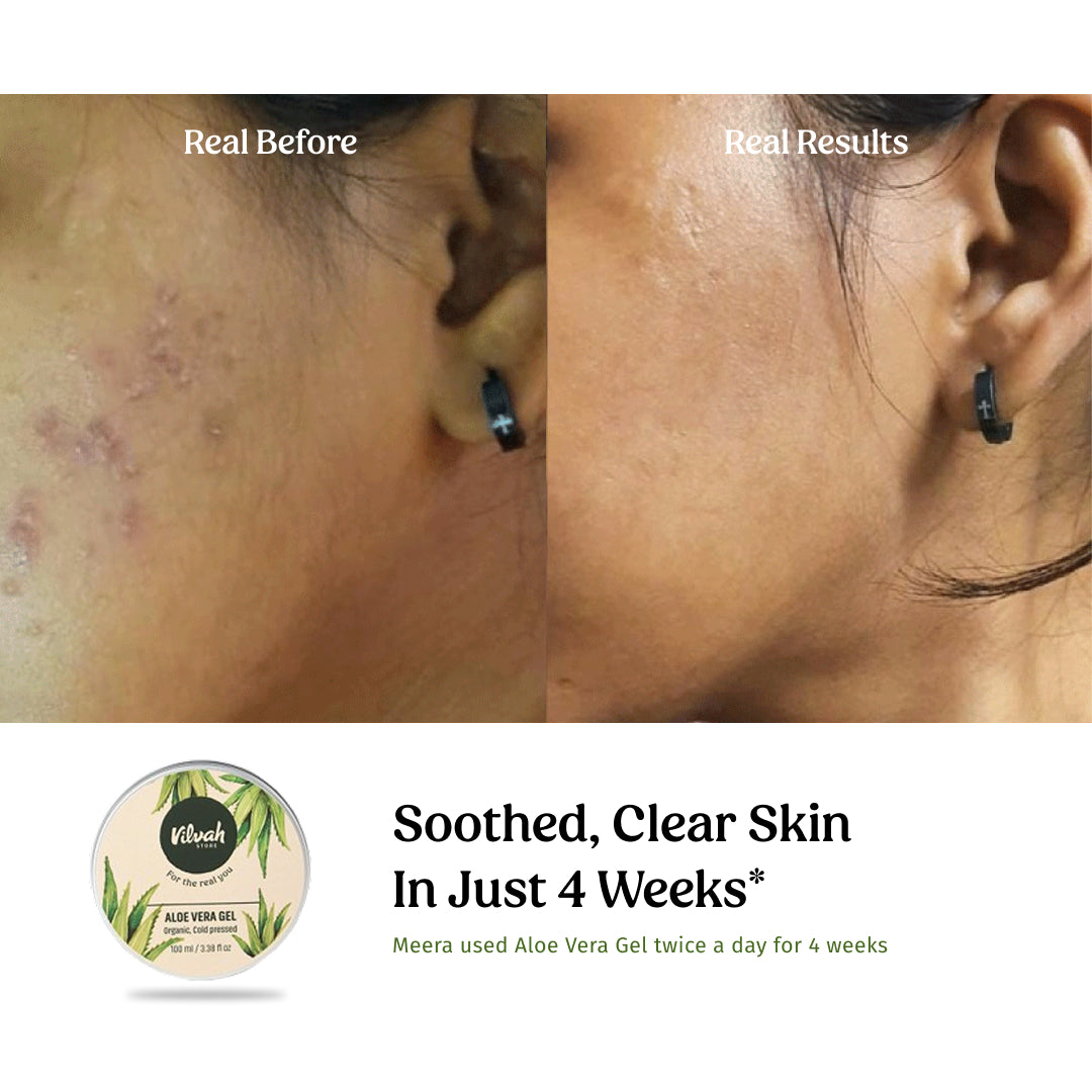 Aloe Vera Gel (Multi-Purpose Skin & Hair Care)
