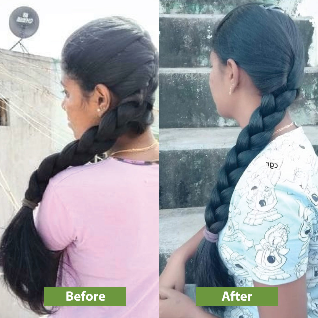 Hair Strengthening Kit