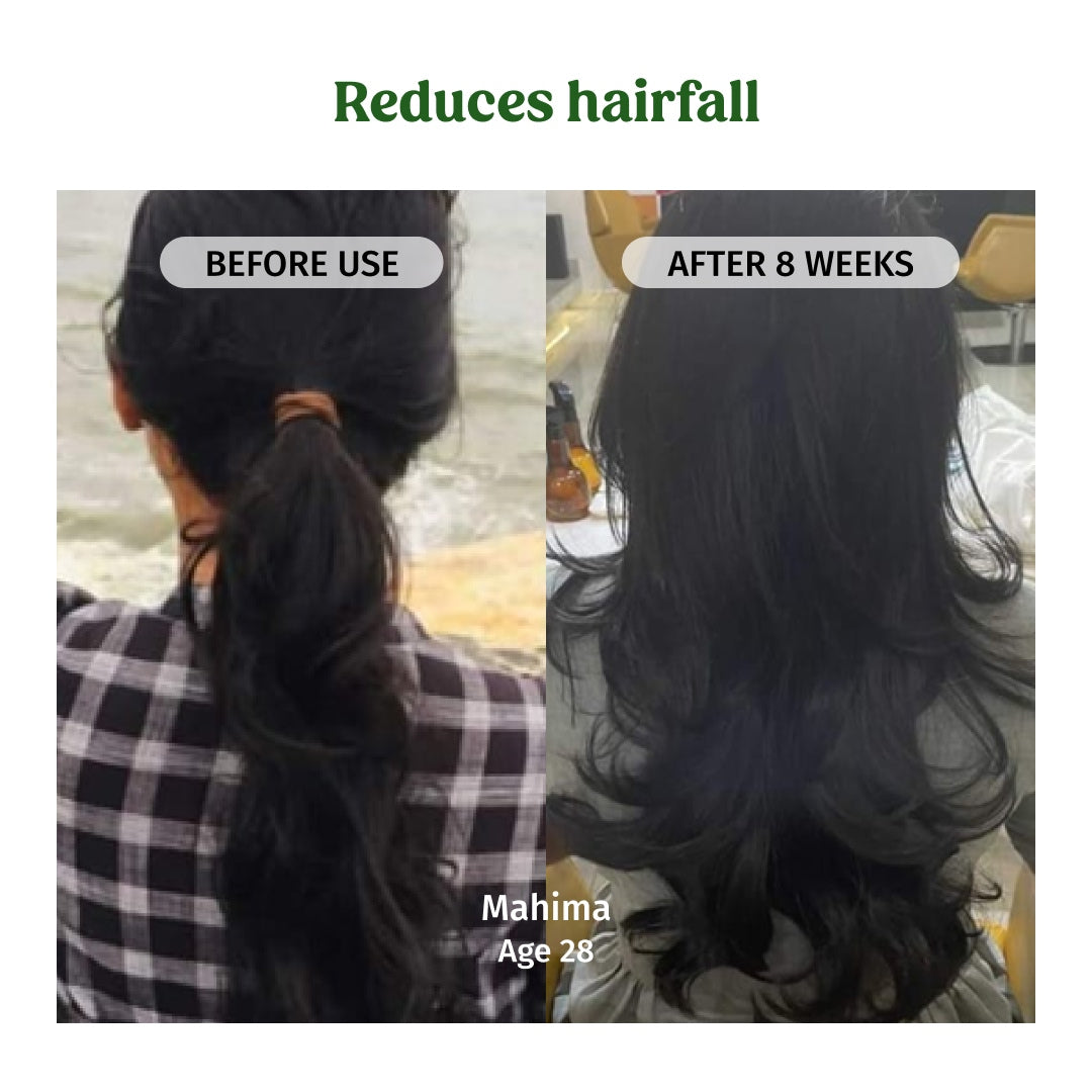 Hair Regrowth Oil