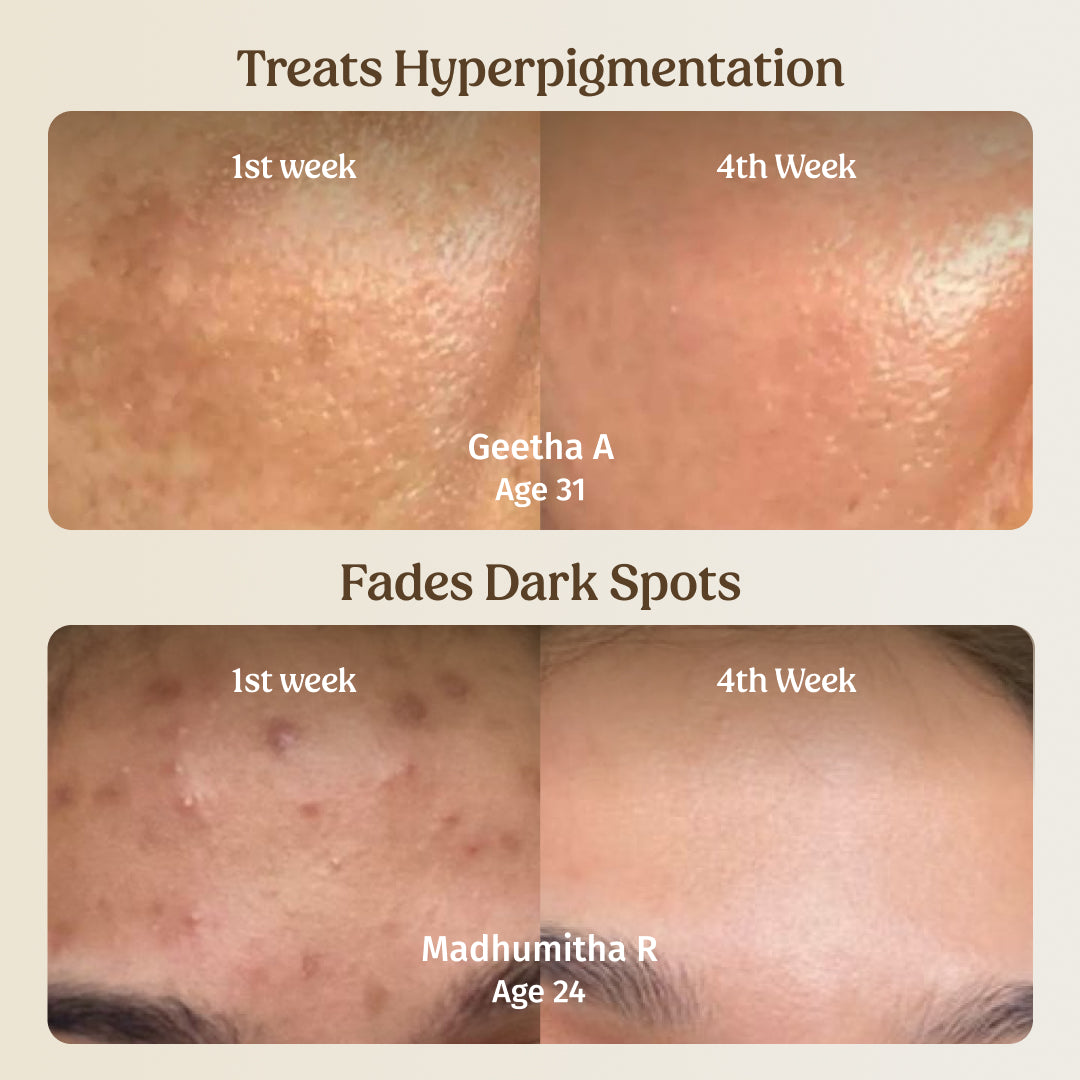 Milk Drops Brightening Serum (Skin Brightening)