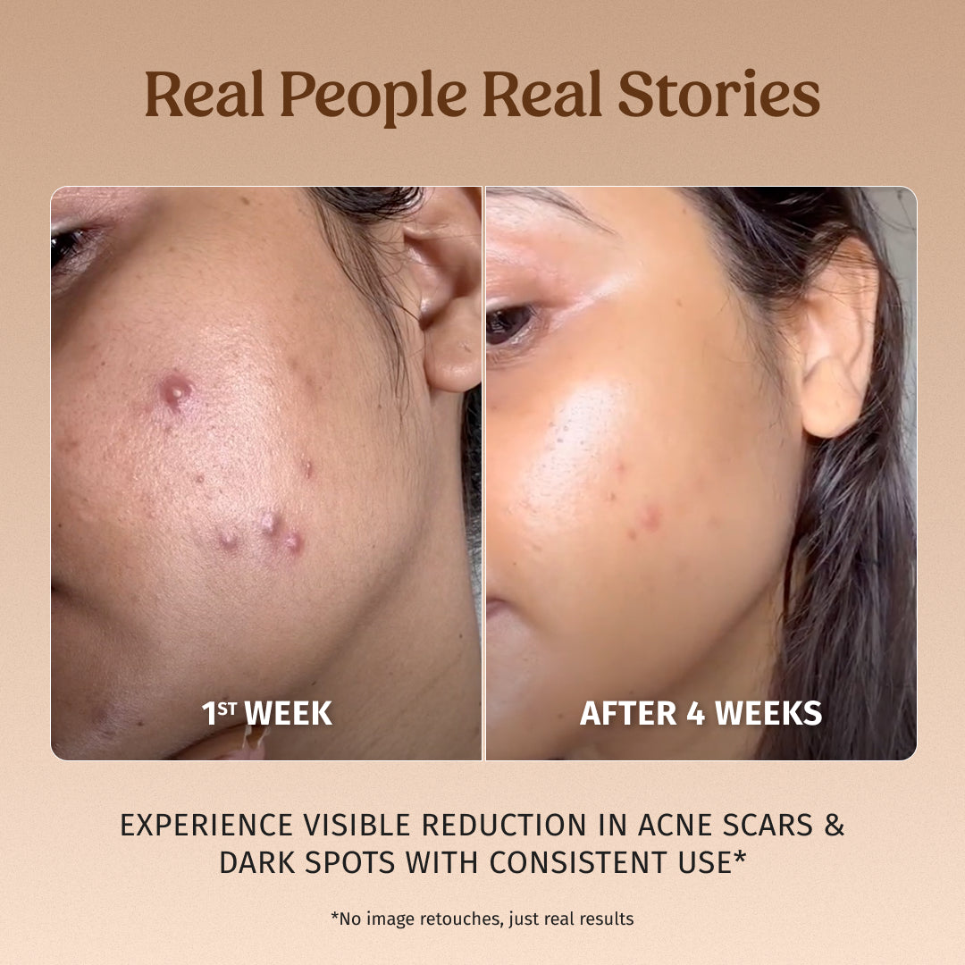 Milk Drops Brightening Serum (Skin Brightening)