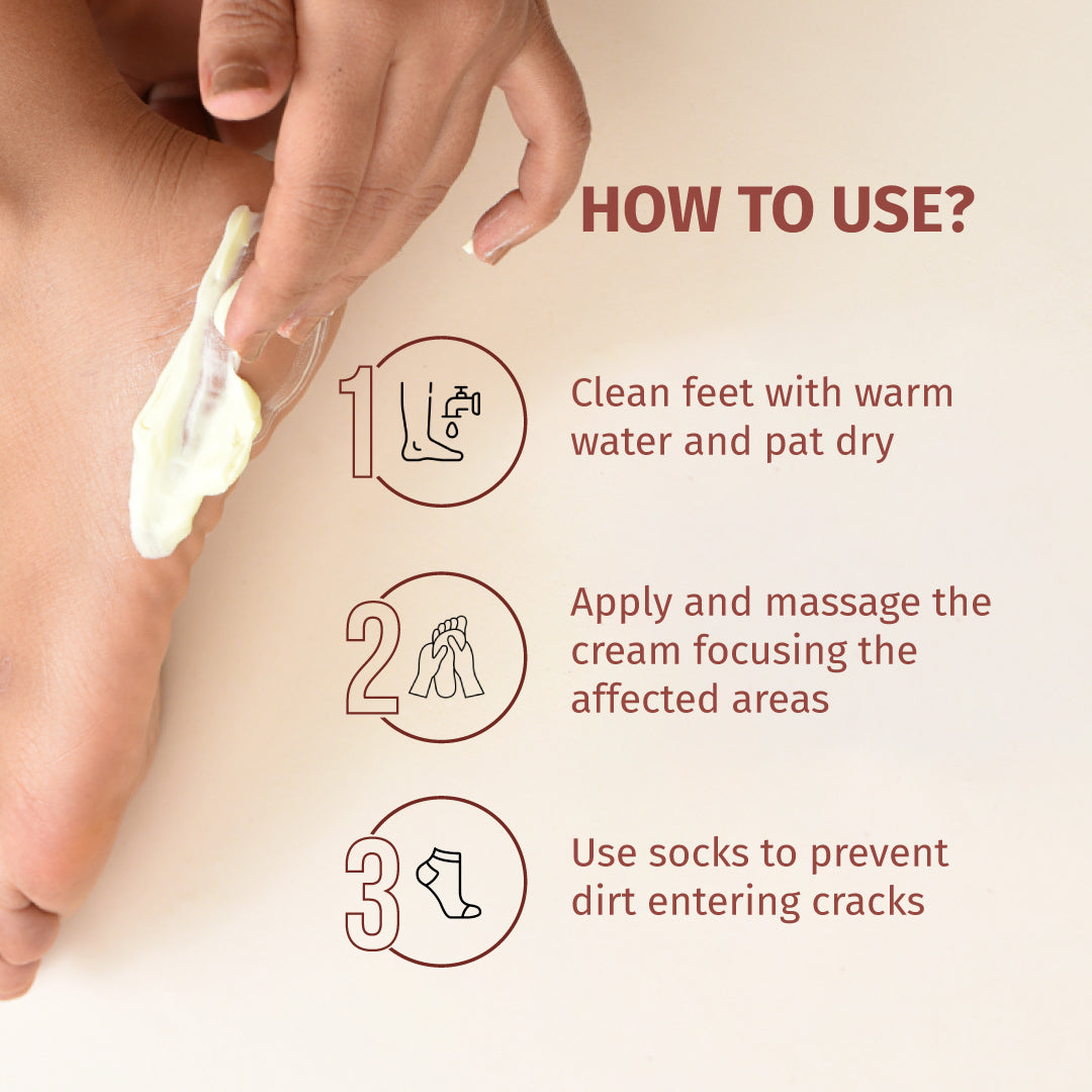 Foot Cream (Treats Cracked Heels)