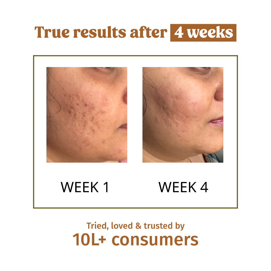 Milk Mud Mask (Immediate Brightness)