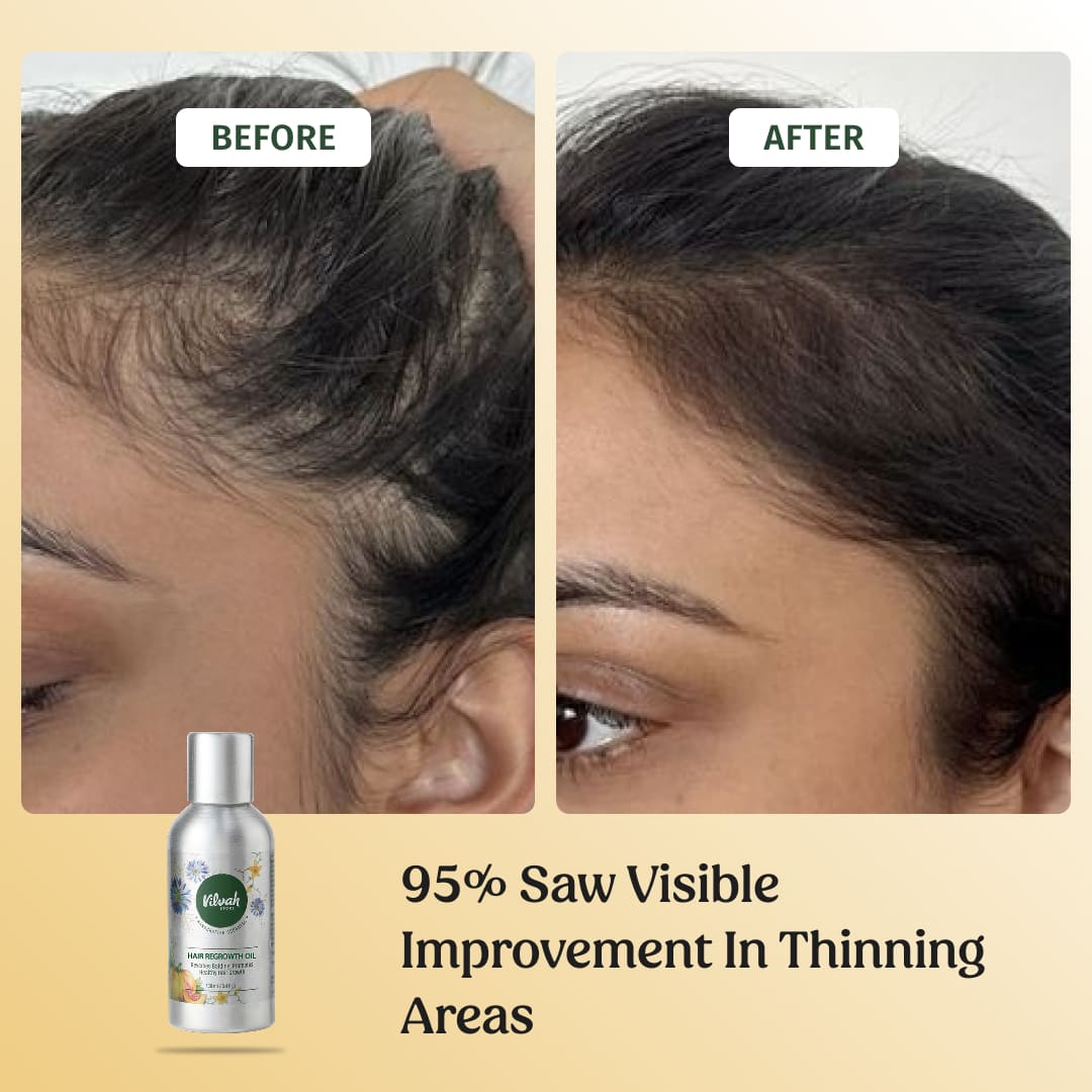 Hair Regrowth Oil