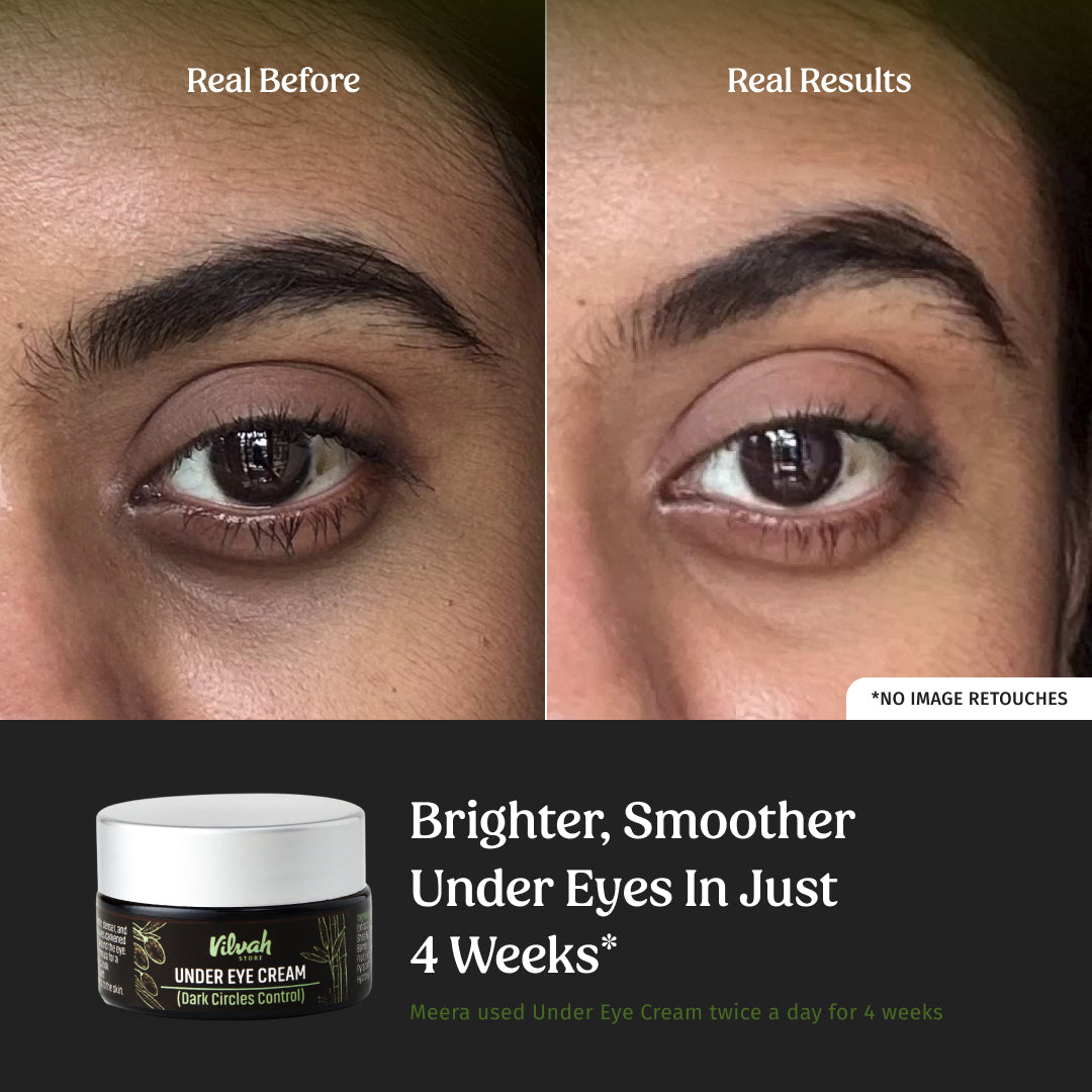 Under eye cream (Dark Circle Control)