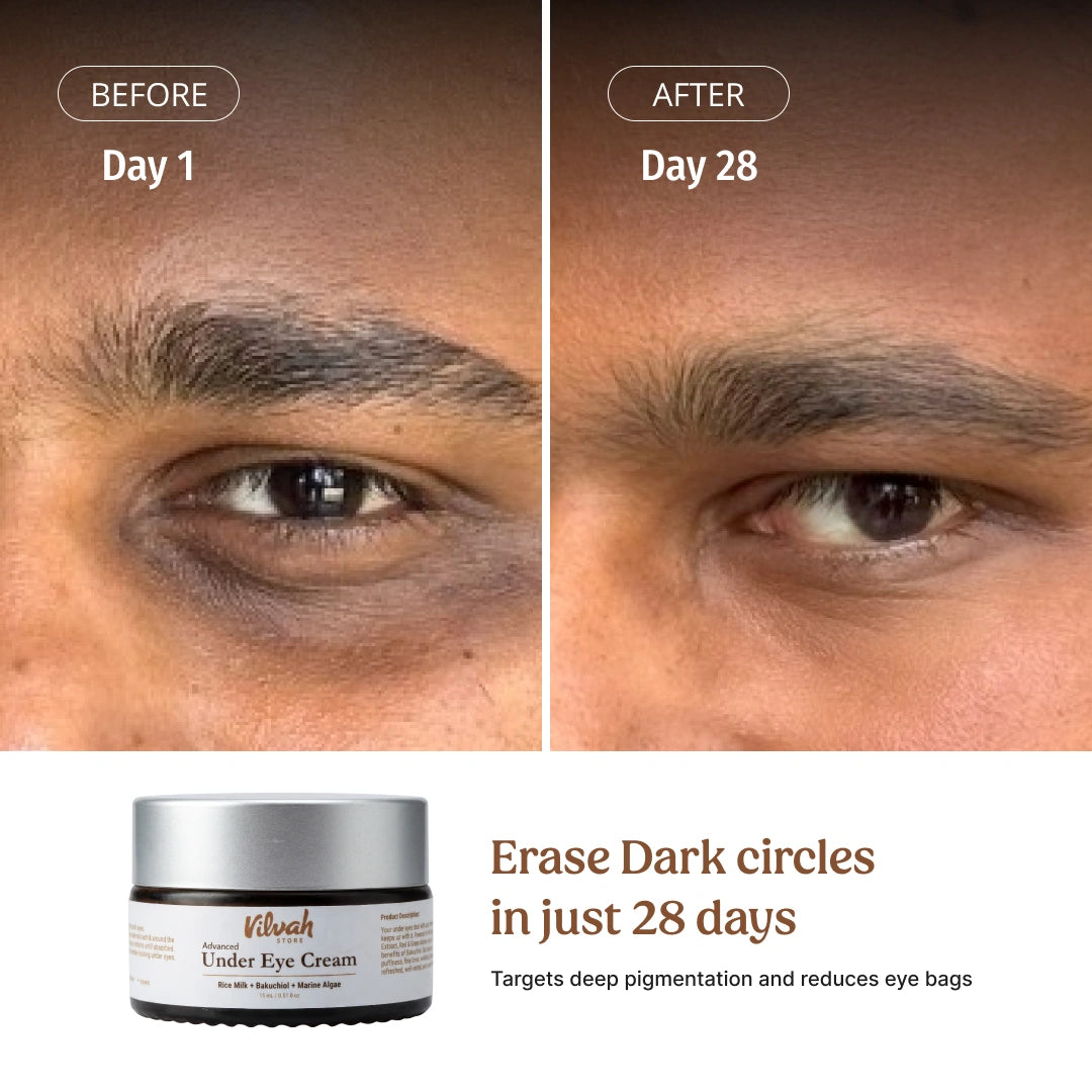 Face Lift Kit (Advanced)