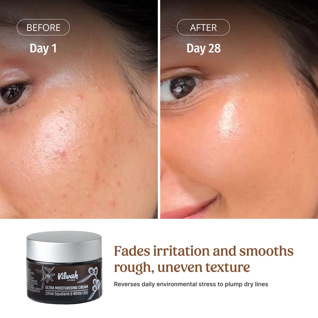 Face Lift Kit (Advanced)