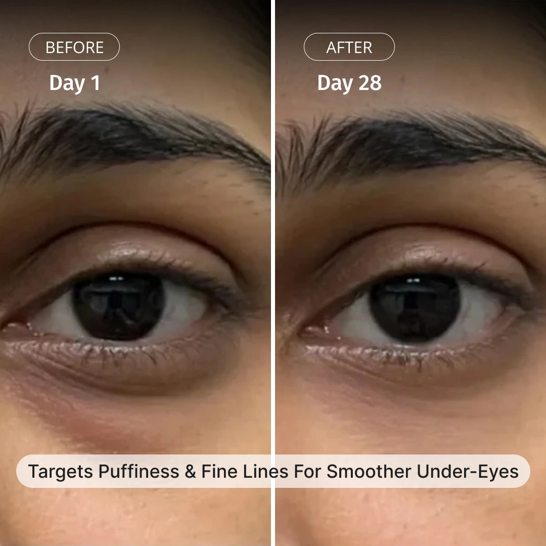Advanced Under Eye Cream