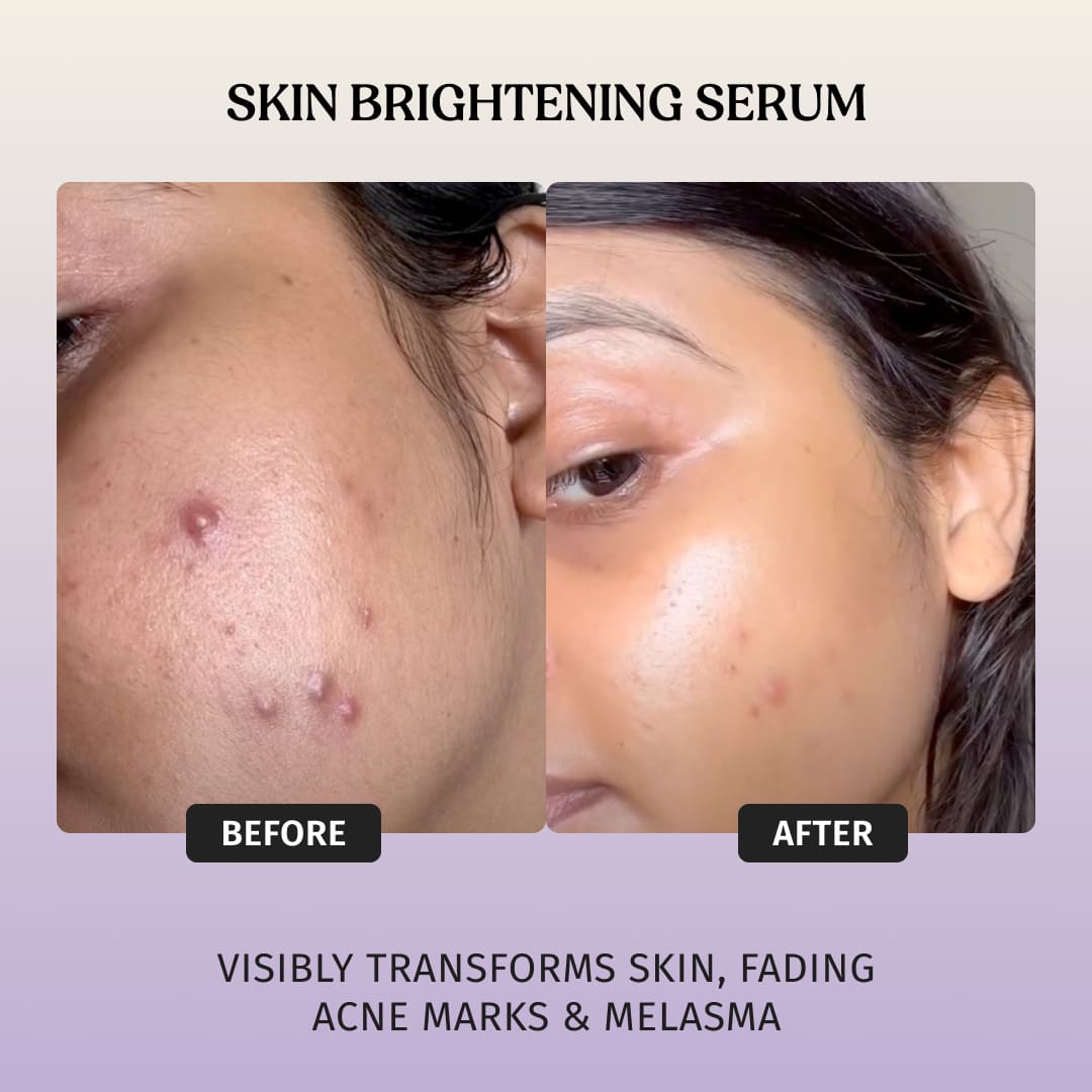 AM PM Serum Kit