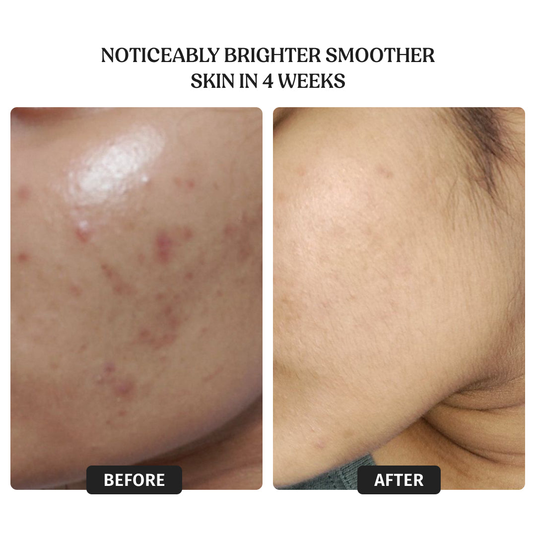 Brightening Ritual Kit