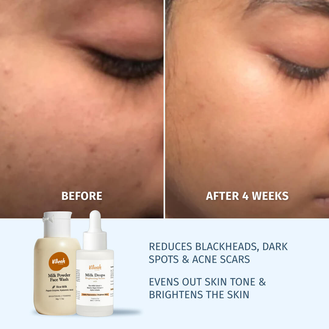 Face Brightening Kit (Large)