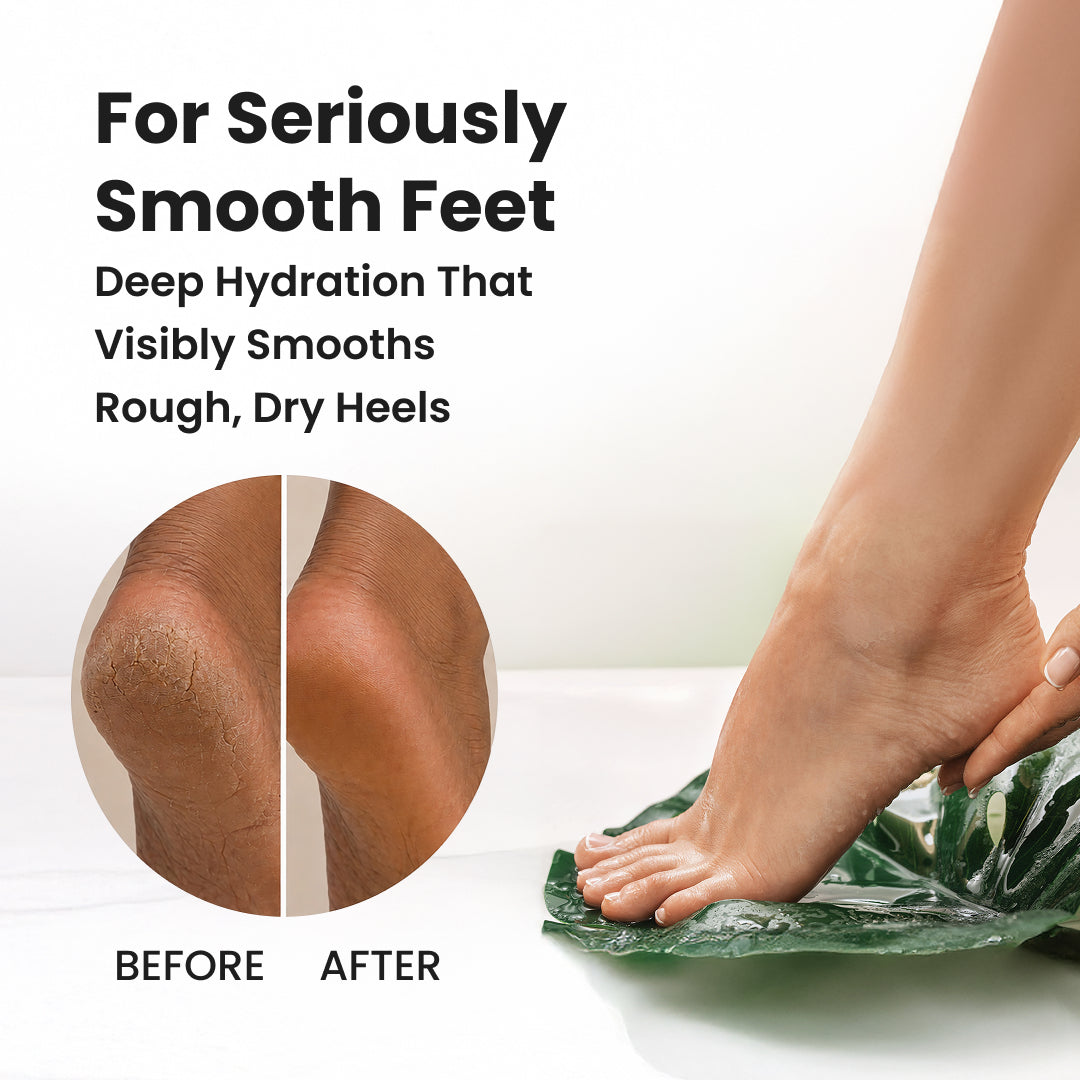 Foot Cream Pack of 2 (Treats Cracked Heels)