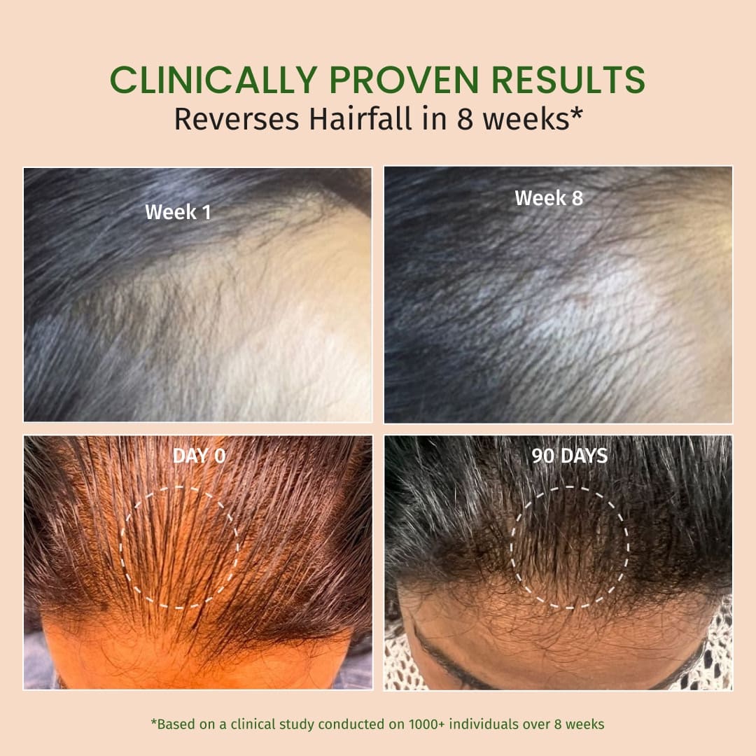 Hair Growth Serum