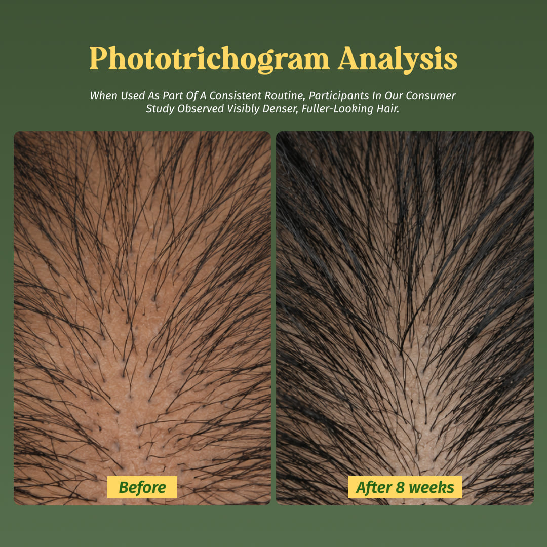 Hair Growth Serum