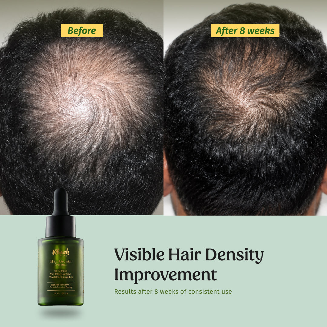 Hair Growth Kit