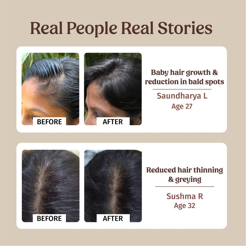 Hairfall Control Kit