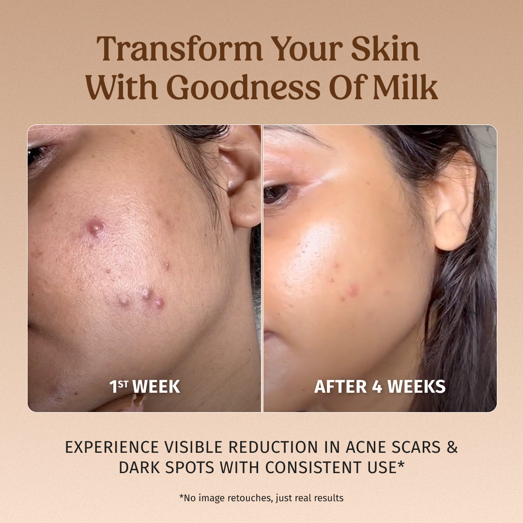 Milk Drops Brightening Serum 40ml Pack of Two