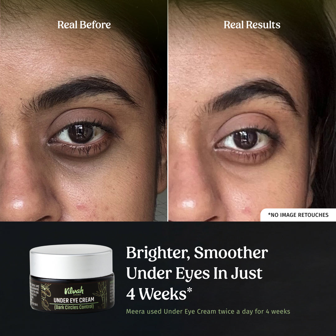 Under eye cream (Dark Circle Control)