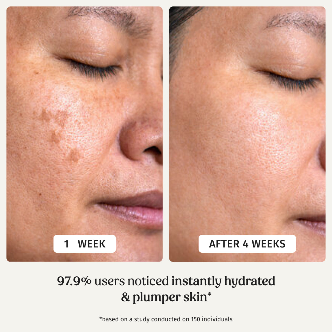 Ultra Moisturising Cream (Fine lines & Wrinkles)